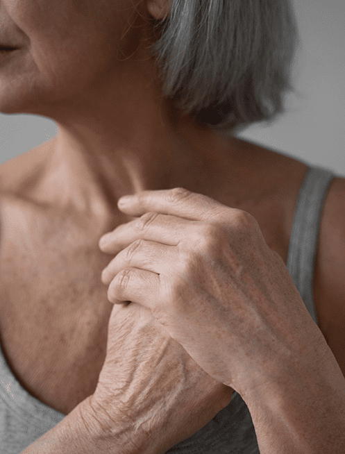 costo-de-tratamiento-para-osteoporosis.png